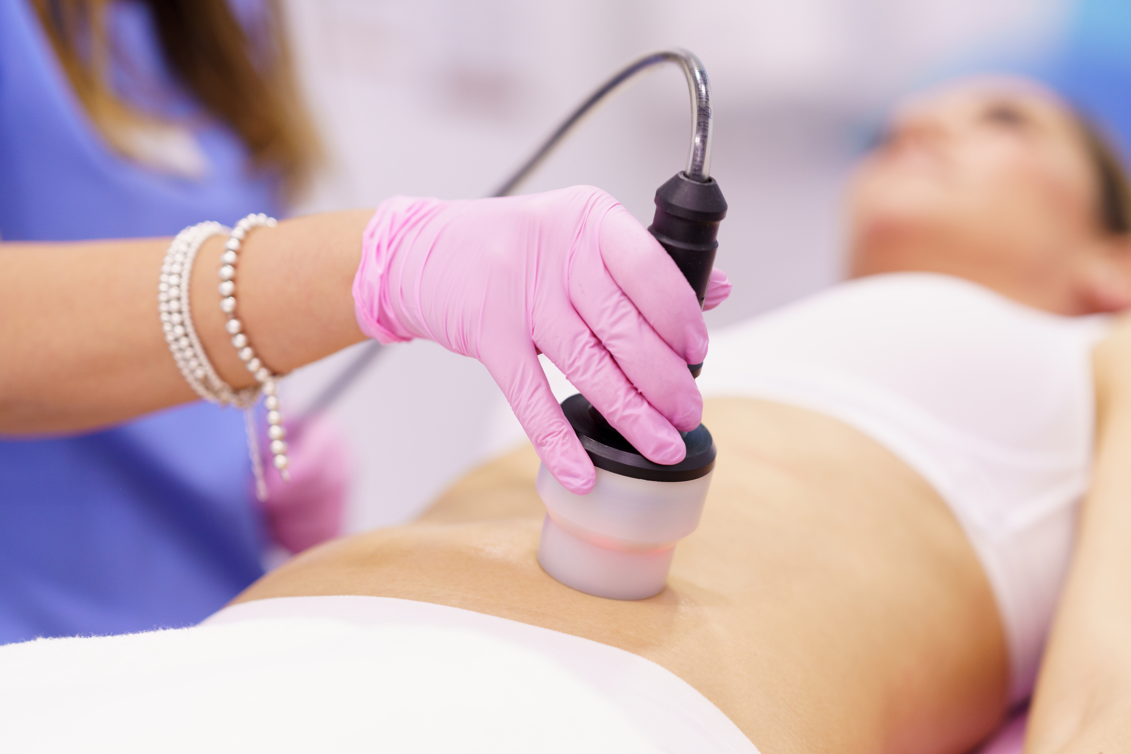 Woman Receiving Anti Cellulite Treatment on Her Belly